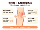 湿疹是什么原因造成的